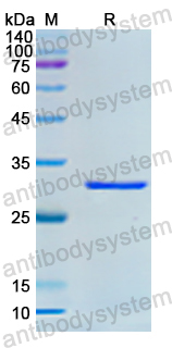 Recombinant Human DGKE Protein, N-His