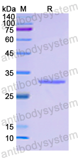 Recombinant Human MAP2K6 Protein, N-His