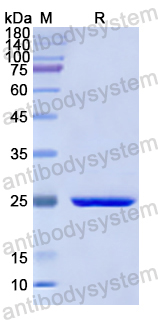 Recombinant Human ARHGDIB Protein, N-His