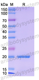 Recombinant Human AGFG1 Protein, N-His