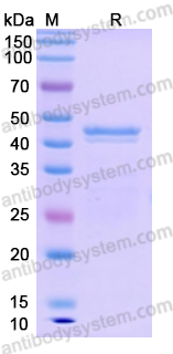 Recombinant Human KIF11 Protein, N-His