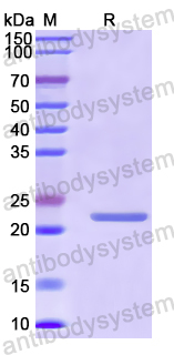 Recombinant Human ZNF143 Protein, N-His