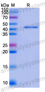 Recombinant Human SMS Protein, N-His