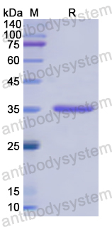 Recombinant Human HK2 Protein, N-His