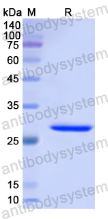 Recombinant Human HK3 Protein, N-His