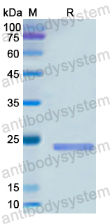 Recombinant Human EFNB2 Protein, N-His