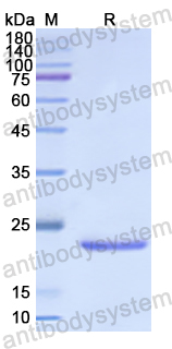 Recombinant Human EFNA5 Protein, N-His