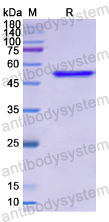 Recombinant Human STC1 Protein, N-GST