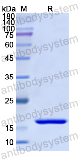 Recombinant Human DGKQ Protein, N-His