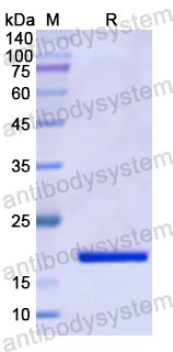 Recombinant Human THOP1 Protein, N-His