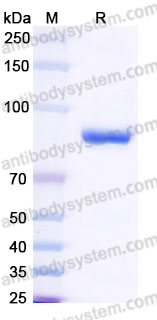 Recombinant Human THOP1 Protein, C-His