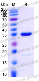 Recombinant Human AKR1C2 Protein, Tag free