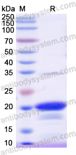 Recombinant Human HMGA2 Protein, N-His