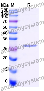 Recombinant Human HMGA2 Protein, N-His-SUMO