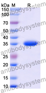 Recombinant Human PDX1 Protein, N-GST & C-His