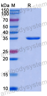 Recombinant Human NKX2-5 Protein, N-GST & C-His