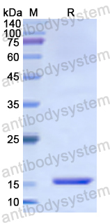 Recombinant Human BLVRA Protein, N-His