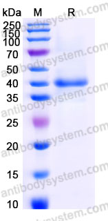 Recombinant Human BLVRA Protein, C-His