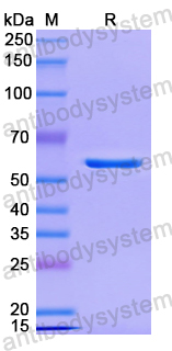 Recombinant Human PPP5C Protein, N-His
