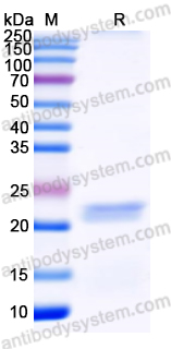 Recombinant Human PLK1 Protein, N-His