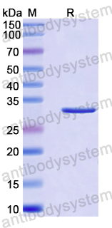 Recombinant Human NUDT6 Protein, N-His