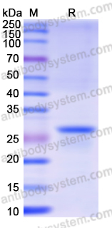 Recombinant Human COL4A4 Protein, N-His
