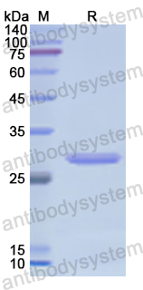 Recombinant Human CTSC Protein, N-His