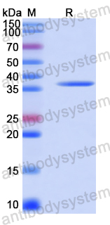 Recombinant Human LIMK2 Protein, N-His