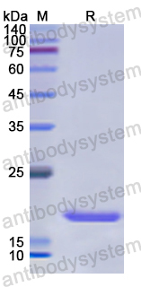 Recombinant Human AP2S1 Protein, N-His