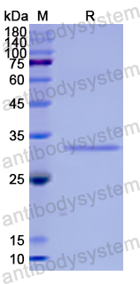 Recombinant Human HCCS Protein, N-His