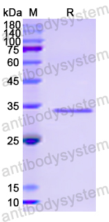 Recombinant Human MAPK12 Protein, N-His