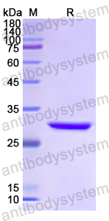 Recombinant Human MAPK10 Protein, N-His