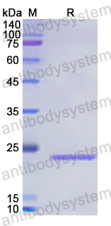 Recombinant Human RCAN1 Protein, N-His