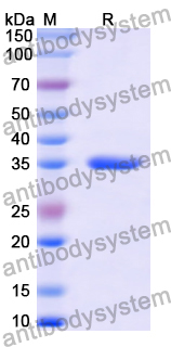 Recombinant Human SLC16A1/MCT1 Protein, N-GST & C-His