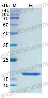 Recombinant Human RARS1 Protein, N-His
