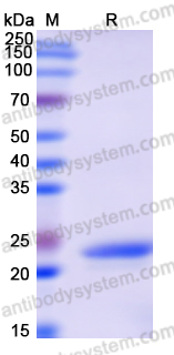 Recombinant Human ATXN3 Protein, N-His