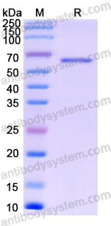 Recombinant Human YARS1 Protein, N-His