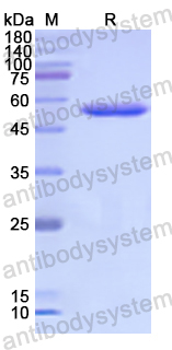 Recombinant Human USP14 Protein, N-His