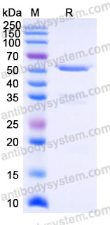 Recombinant Human USP14 Protein, N-His