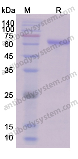 Recombinant Human PRKAA2 Protein, N-His