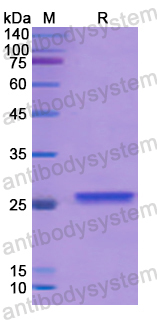 Recombinant Human BCAT1 Protein, N-His