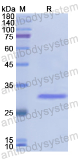 Recombinant Human NAGLU Protein, N-His