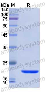 Recombinant Human GALC Protein, N-His