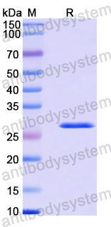 Recombinant Human AK2 Protein, N-His