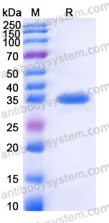 Recombinant Human NAPA Protein, N-His