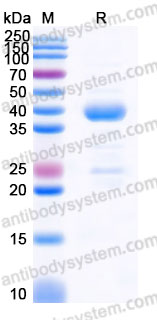 Recombinant Human ADPRH Protein, N-His
