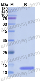 Recombinant Human SLURP1 Protein, N-His