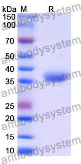 Recombinant Human SLURP1 Protein, N-GST & C-His
