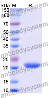 Recombinant Human MFAP2 Protein, N-His