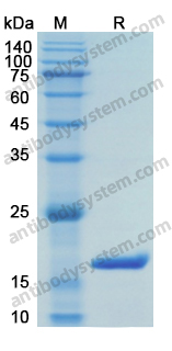 Recombinant Human AIF1/IBA1 Protein, N-His